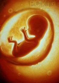 胎停育一般发生在孕几周